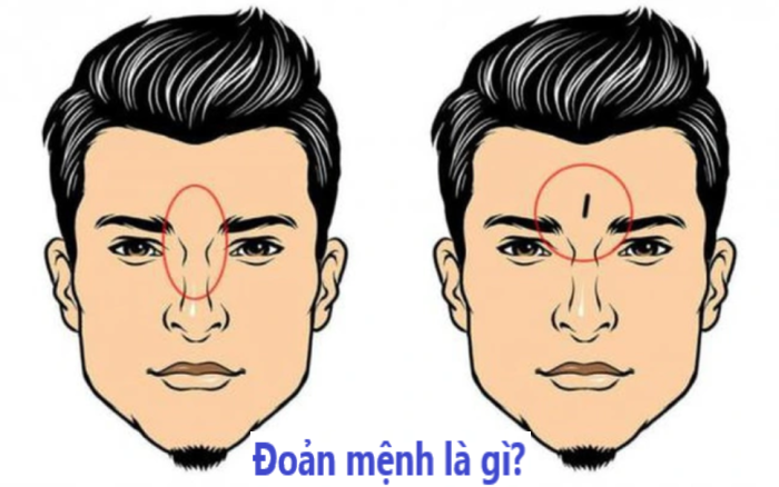 Đoản mệnh là gì? Các dấu hiệu nhận biết người đoản mệnh